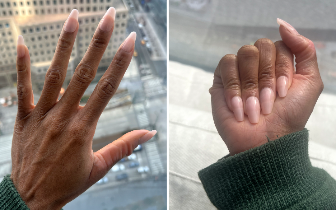 How I’ve Managed To Curb My Skin Picking Disorder Through Manicures — See Photos