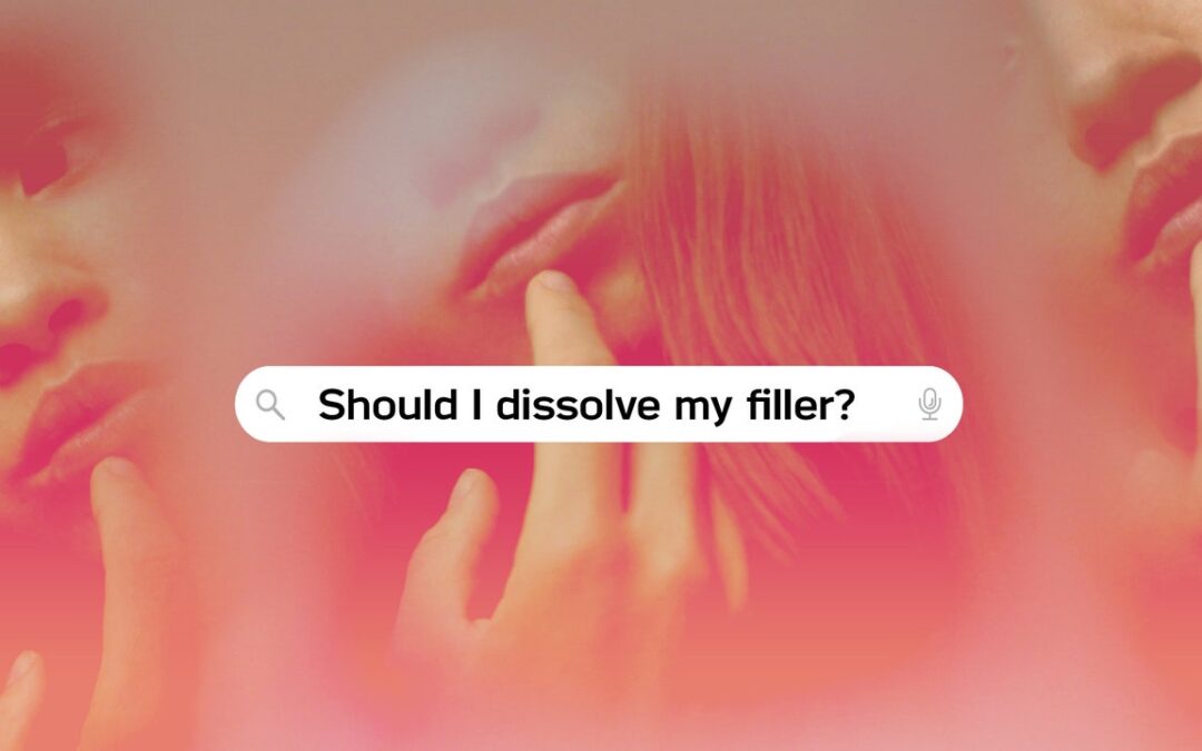 This Is What It’s Really Like to Dissolve Your Filler
