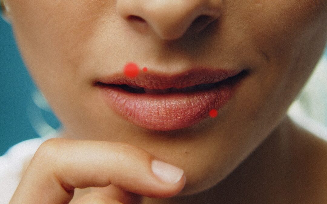 Cold Sore vs Pimple: How to Prevent, Treat, and Tell the Difference Between Them
