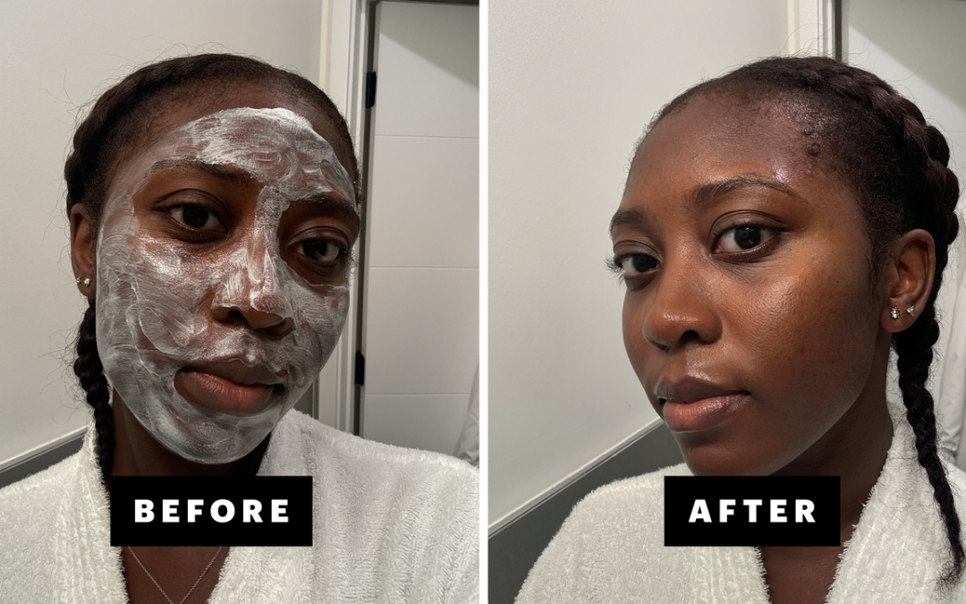 I Tried The Shani Darden Triple Acid Signature Peel — Here Are My Thoughts